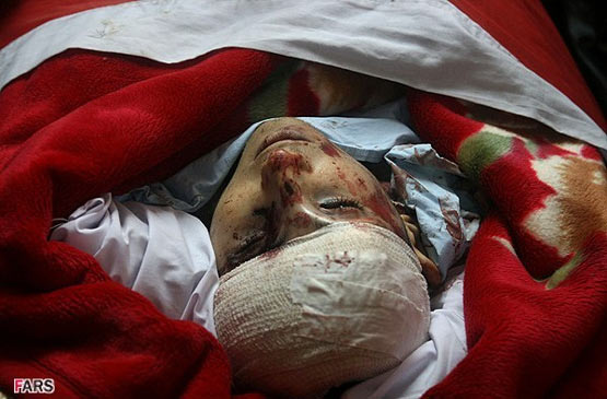 15514 428 mmm1nze4yj - غزه در خون؛ اعراب در خواب + تصاویر